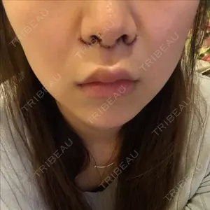 口コミ