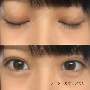 口コミ