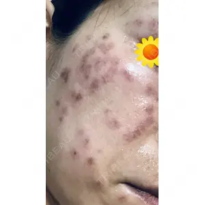 南青山TOKUNAKAクリニック口コミ