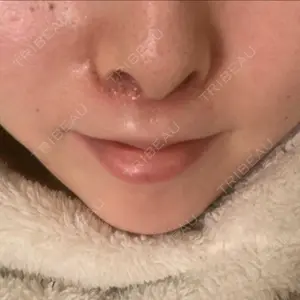 B-LINE CLINIC B-LINE CLINIC 池袋院口コミ