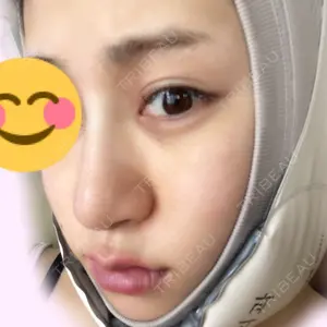 RG整形外科（旧リオン整形外科）口コミ