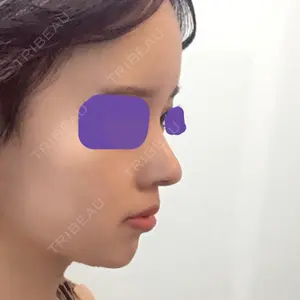 口コミ