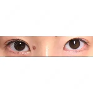 松下皮フ形成外科口コミ