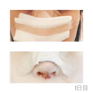 FROM B整形外科 (旧バウム整形外科)口コミ