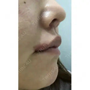 清潭女神美容外科の