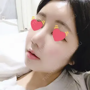 View美容整形外科口コミ