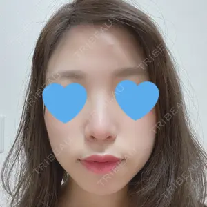 HANABI整形外科口コミ