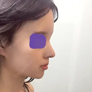 口コミ
