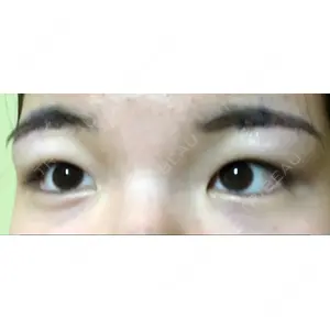 Lovelyan整形外科口コミ