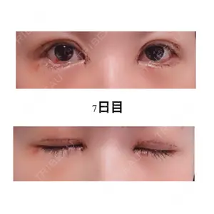 口コミ