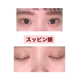 口コミ