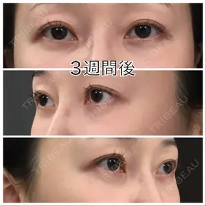 口コミ