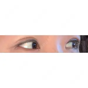 湘南美容クリニック 湘南美容クリニック 京都院口コミ