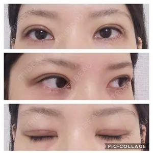 有楽町高野美容クリニック口コミ