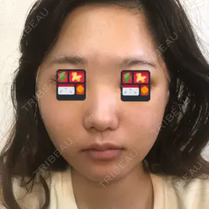 RG整形外科（旧リオン整形外科）口コミ