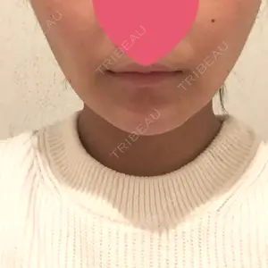 口コミ