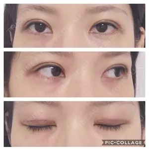 有楽町高野美容クリニック口コミ