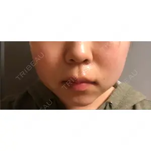 口コミ