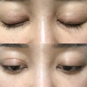湘南美容クリニック 新宿本院の