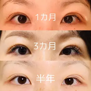 口コミ
