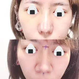口コミ