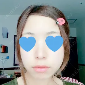 HANABI整形外科口コミ