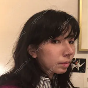 口コミ