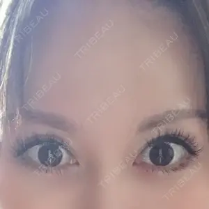 ライアン美容外科口コミ