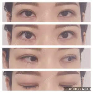 有楽町高野美容クリニック口コミ