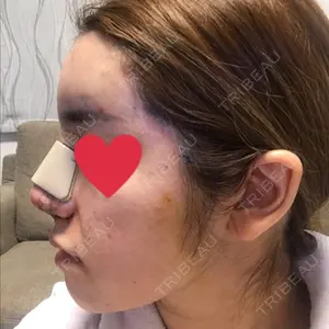 Zetith Beauty Clinic 銀座院口コミ