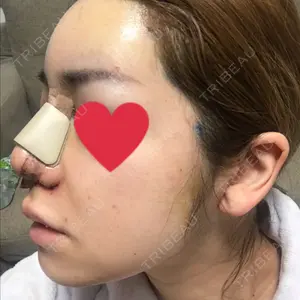 Zetith Beauty Clinic 銀座院口コミ