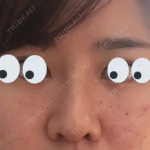 口コミ