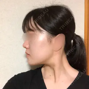 RG整形外科（旧リオン整形外科）口コミ