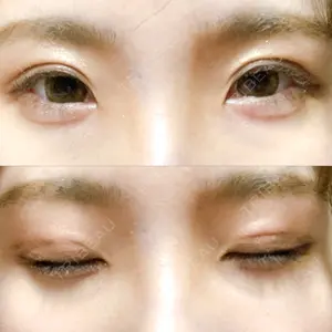 TCB東京中央美容外科 TCB東京中央美容外科 心斎橋筋院口コミ