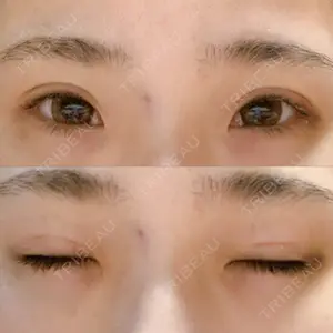 TCB東京中央美容外科 TCB東京中央美容外科 心斎橋筋院口コミ