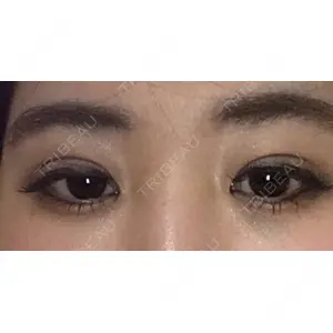 口コミ