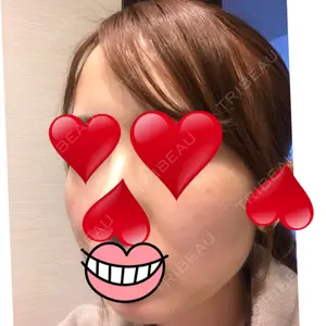 ウィーバー美容外科口コミ