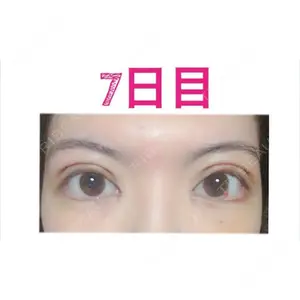 口コミ