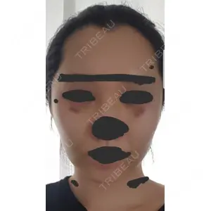 ボンディ美容整形外科（旧リオン整形外科）口コミ