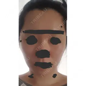 ボンディ美容整形外科（旧リオン整形外科）口コミ