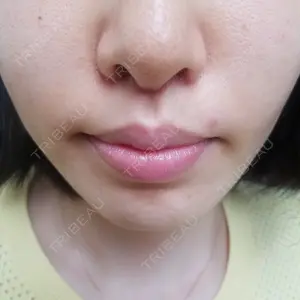 口コミ