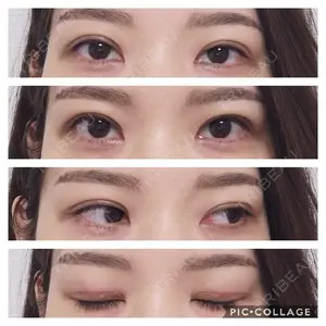 有楽町高野美容クリニック口コミ