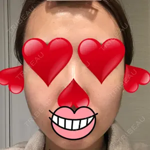 ウィーバー美容外科口コミ