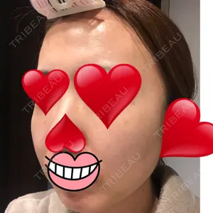ウィーバー美容外科口コミ