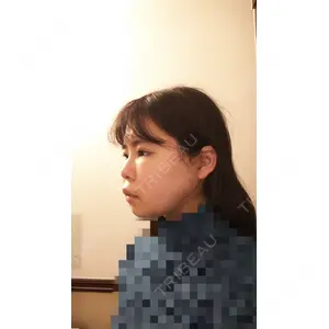 ボンディ美容整形外科（旧リオン整形外科）口コミ