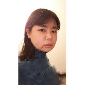 ボンディ美容整形外科（旧リオン整形外科）口コミ