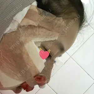 ボンディ美容整形外科（旧リオン整形外科）口コミ