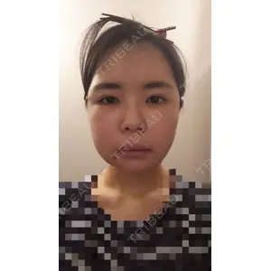 ボンディ美容整形外科（旧リオン整形外科）口コミ