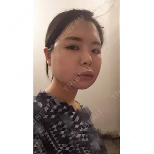 ボンディ美容整形外科（旧リオン整形外科）口コミ