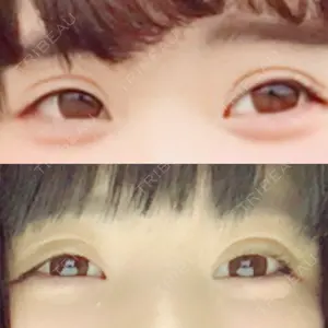 湘南美容クリニック 湘南美容クリニック 宇都宮院口コミ